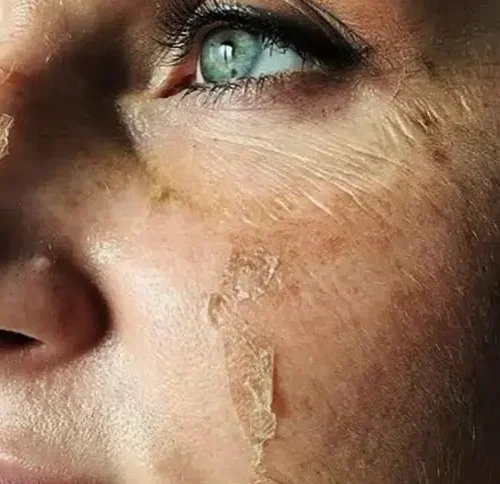 Exfoliation Visage