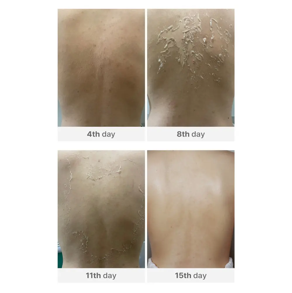 Medisco Peelieve Peeling5 Medisco Peelieve Peeling5